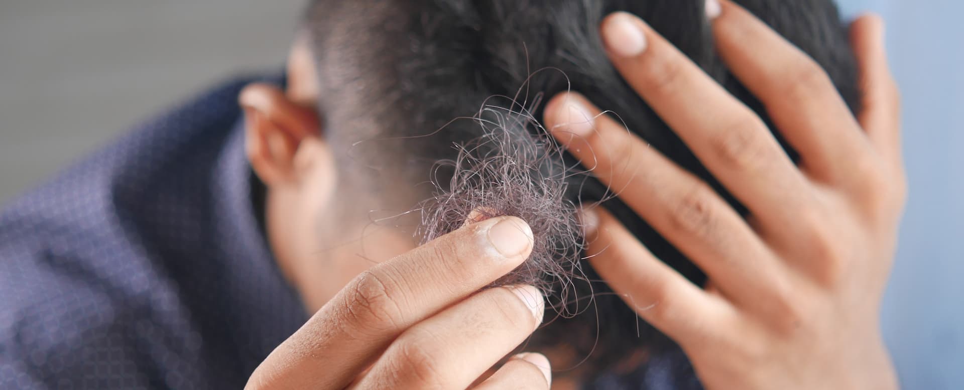 Does Finasteride Really Work?