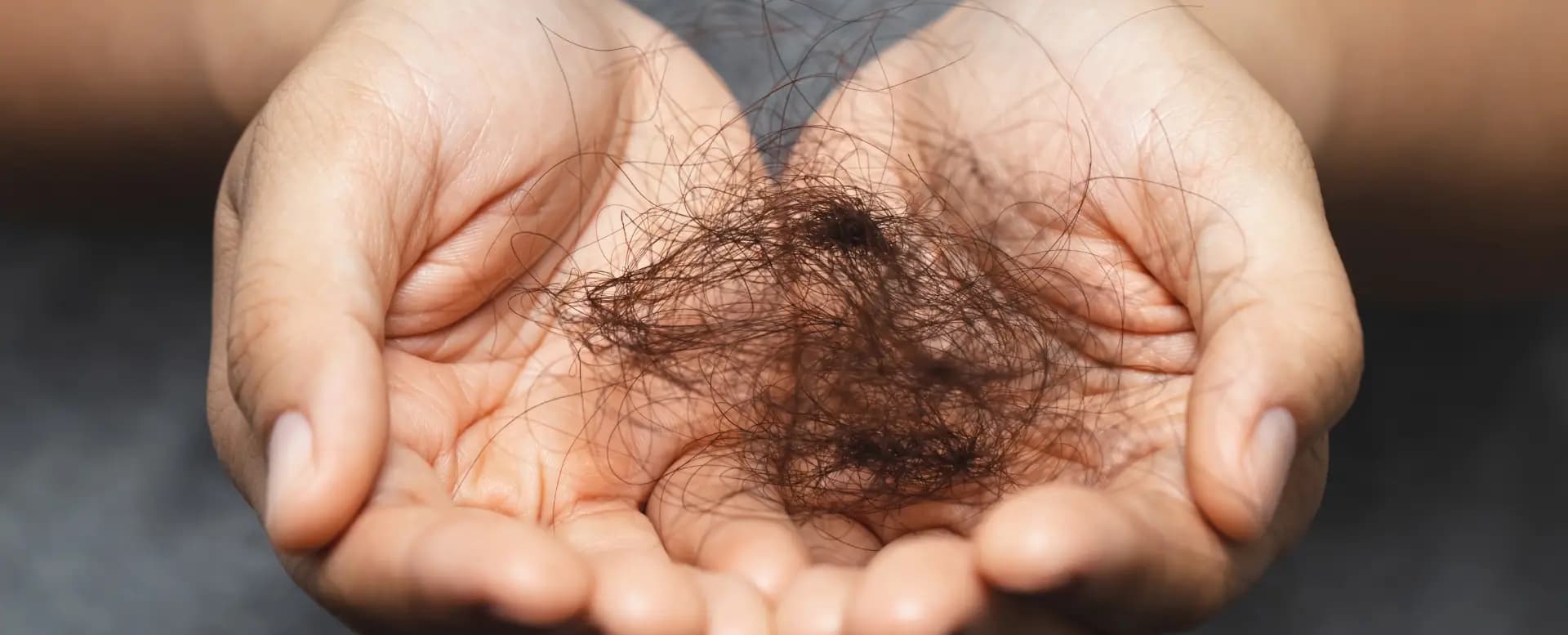 Does Creatine Cause Hair Loss? Evidence Explained