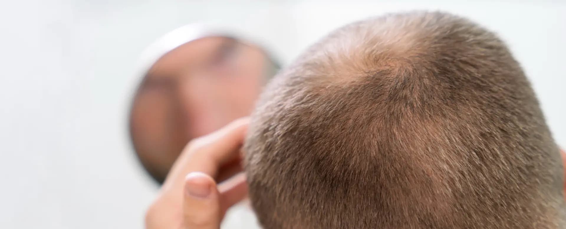 What Medications Can Cause Hair Loss