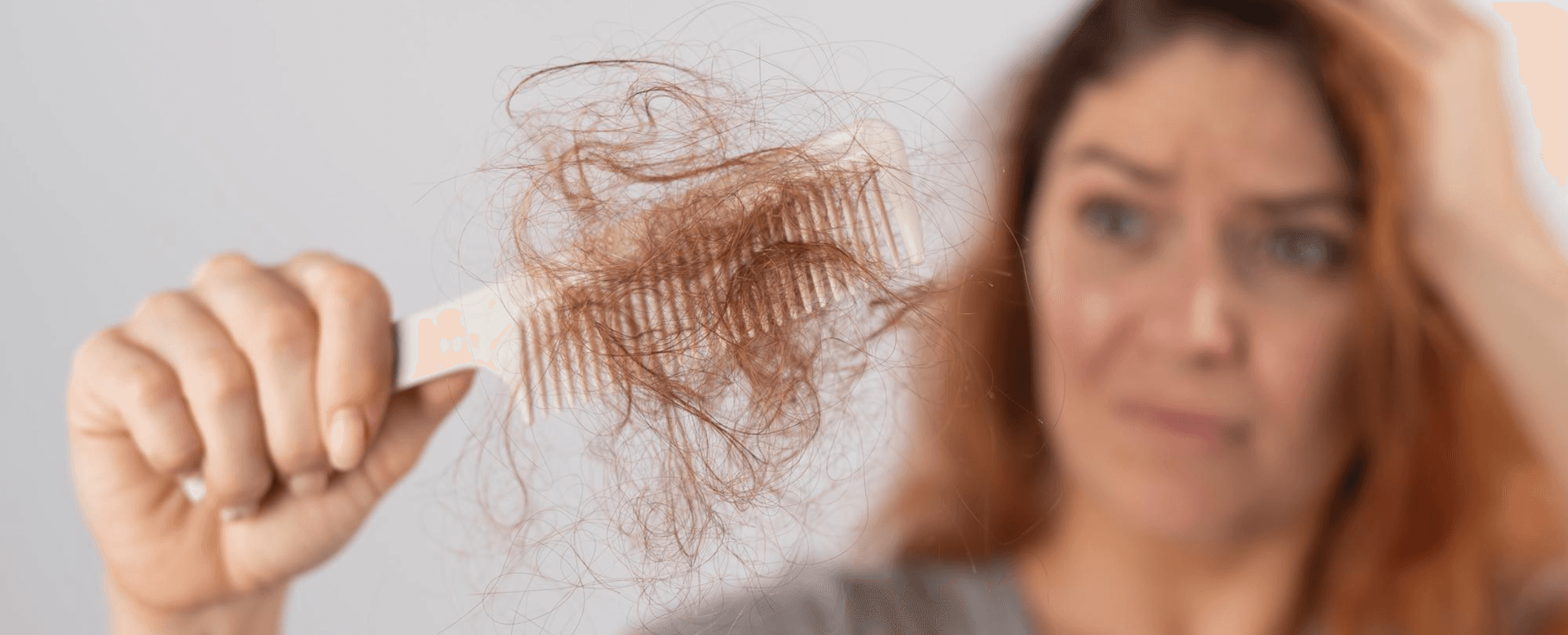 Can Women Take Finasteride? Exploring Treatment Options for Female Hair Loss