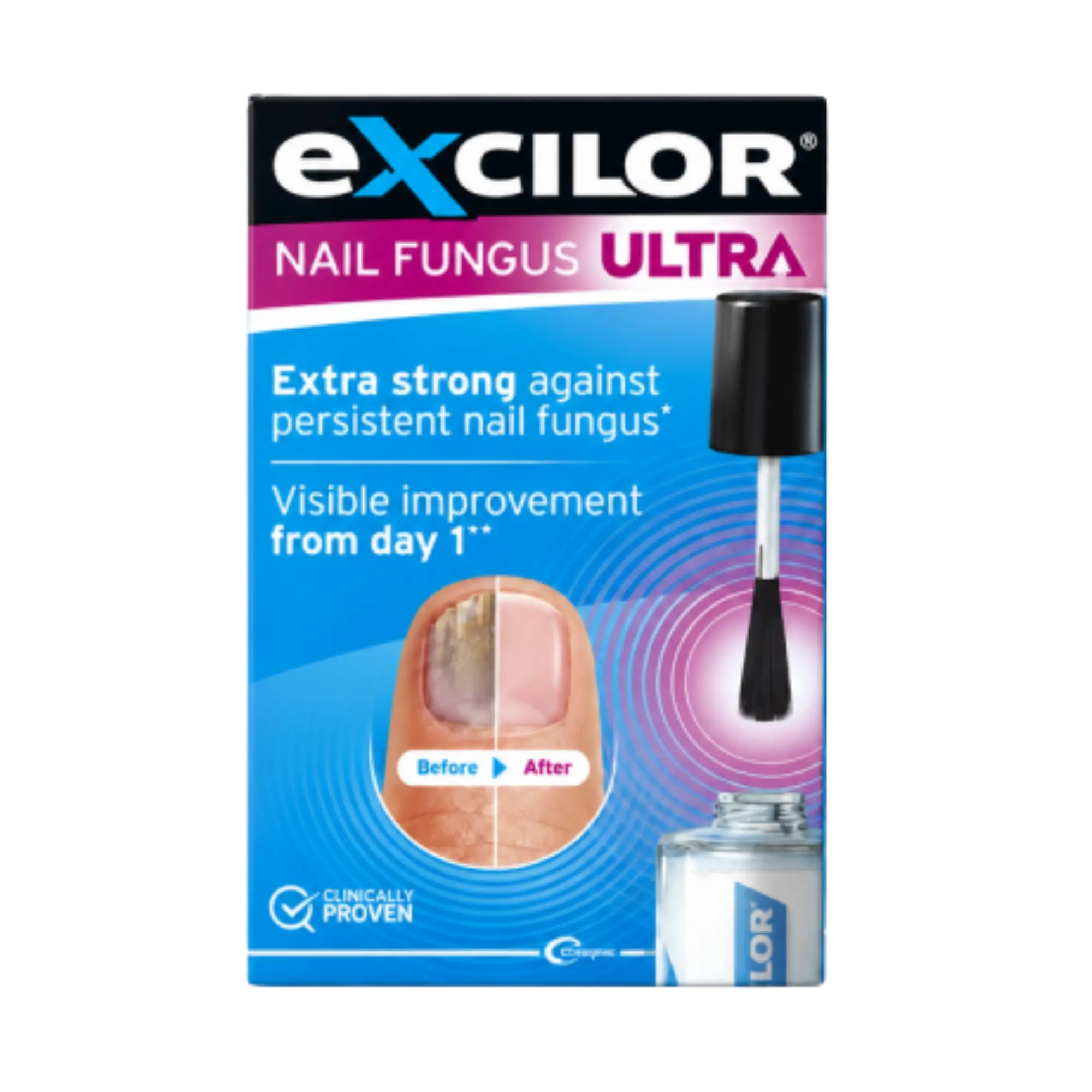 Excilor ULTRA